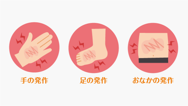 どの部位の発作(腫れ)でも早期治療が重要です