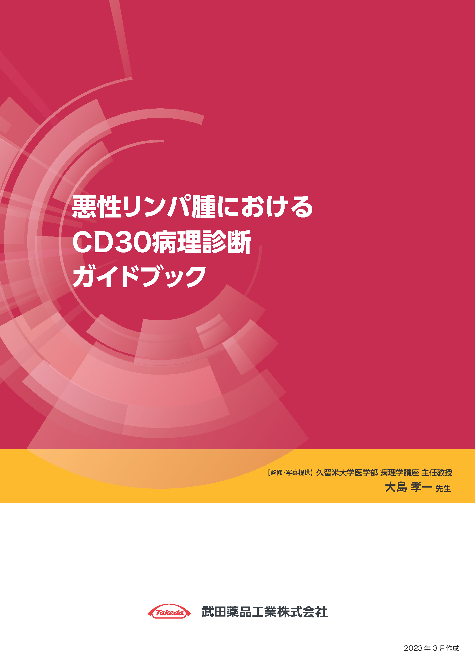 悪性リンパ腫におけるCD30病理診断ガイドブック