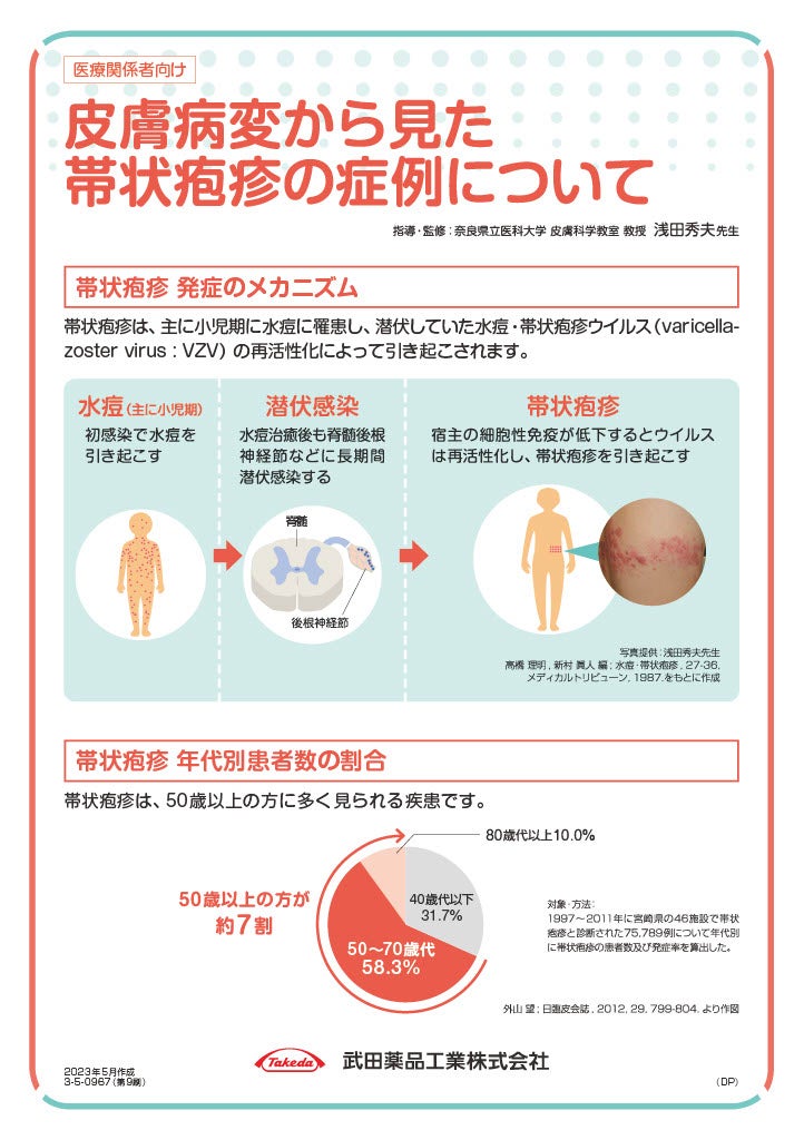 皮膚病変から見た帯状疱疹の症例について