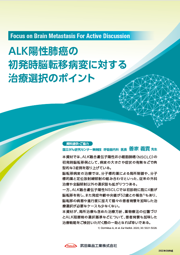 初発時脳転移病変に対する治療選択のポイント