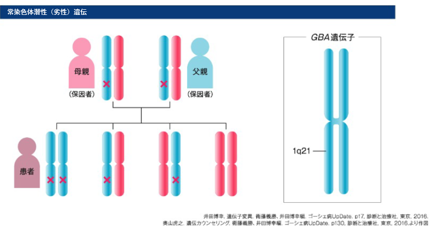 遺伝形式と遺伝子変異 ゴーシェ病 医療関係者向け疾患情報｜【公式