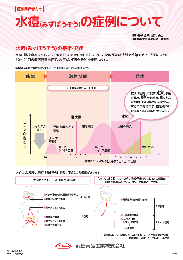 CIP_水痘・帯状疱疹 | Takeda Medical site