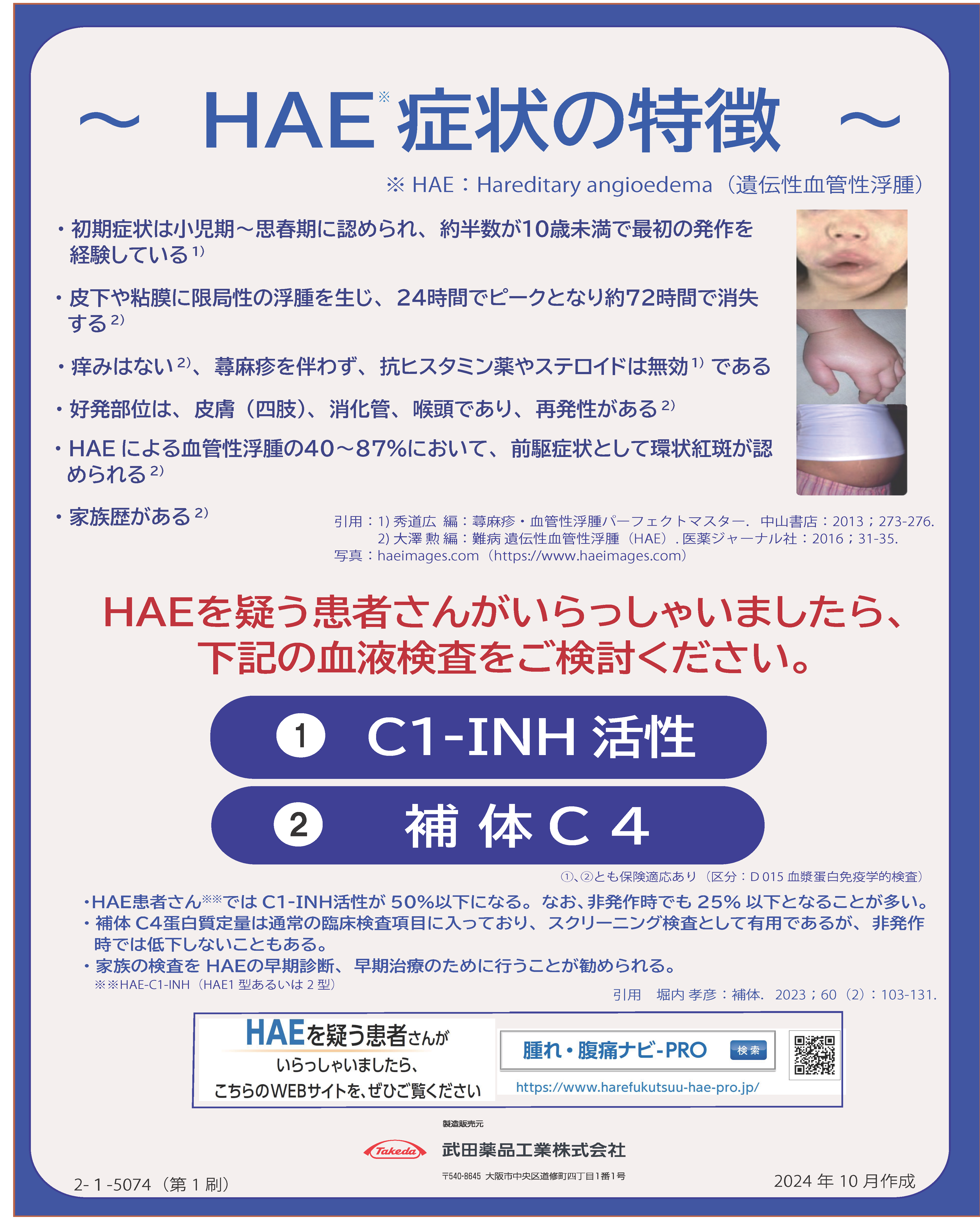 HAE症状の特徴