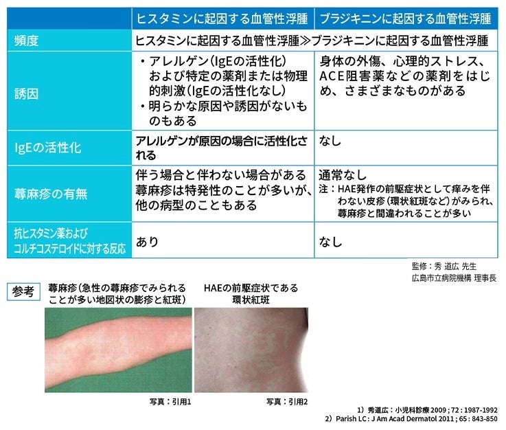 【中古】蕁麻疹・血管性浮腫パーフェクトマスター (皮膚科臨床アセット) 蕁麻疹・血管性浮腫パーフェクトマスター (皮膚科臨床アセット) | 増隆