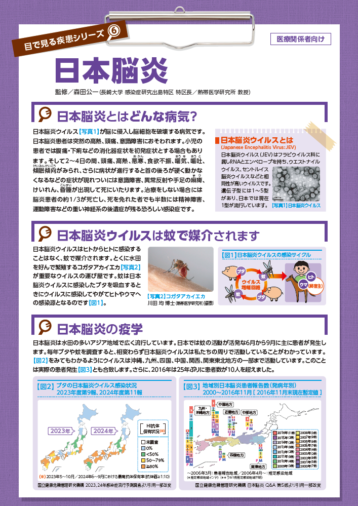 目で見る疾患シリーズ 日本脳炎