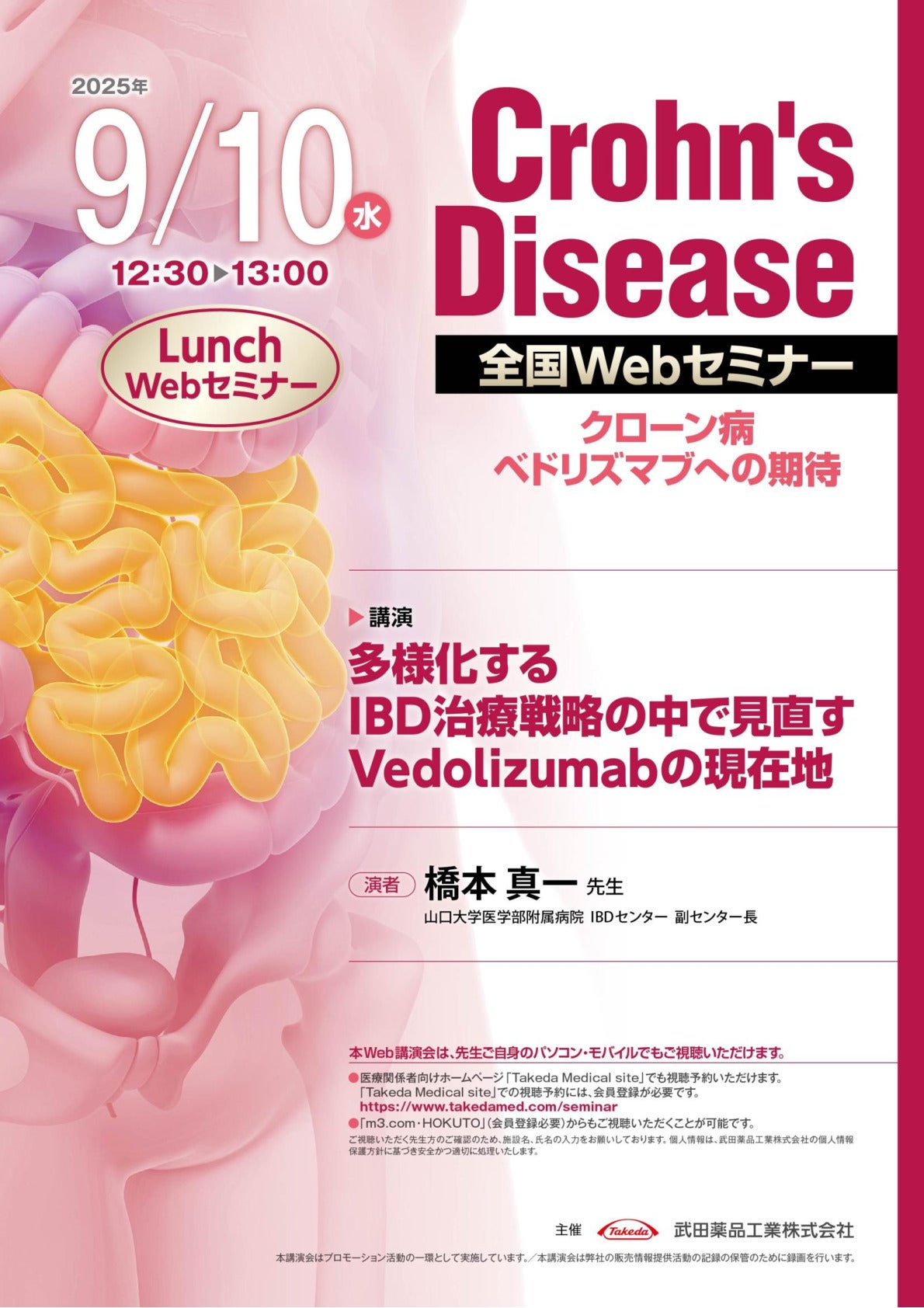 Crohn's