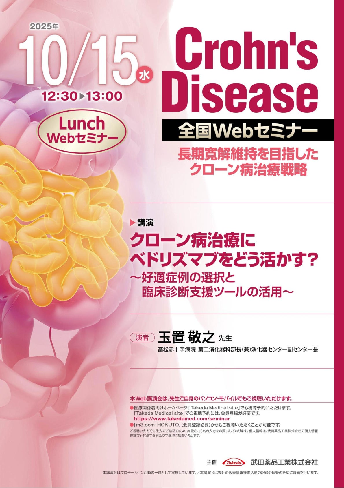 Crohn's