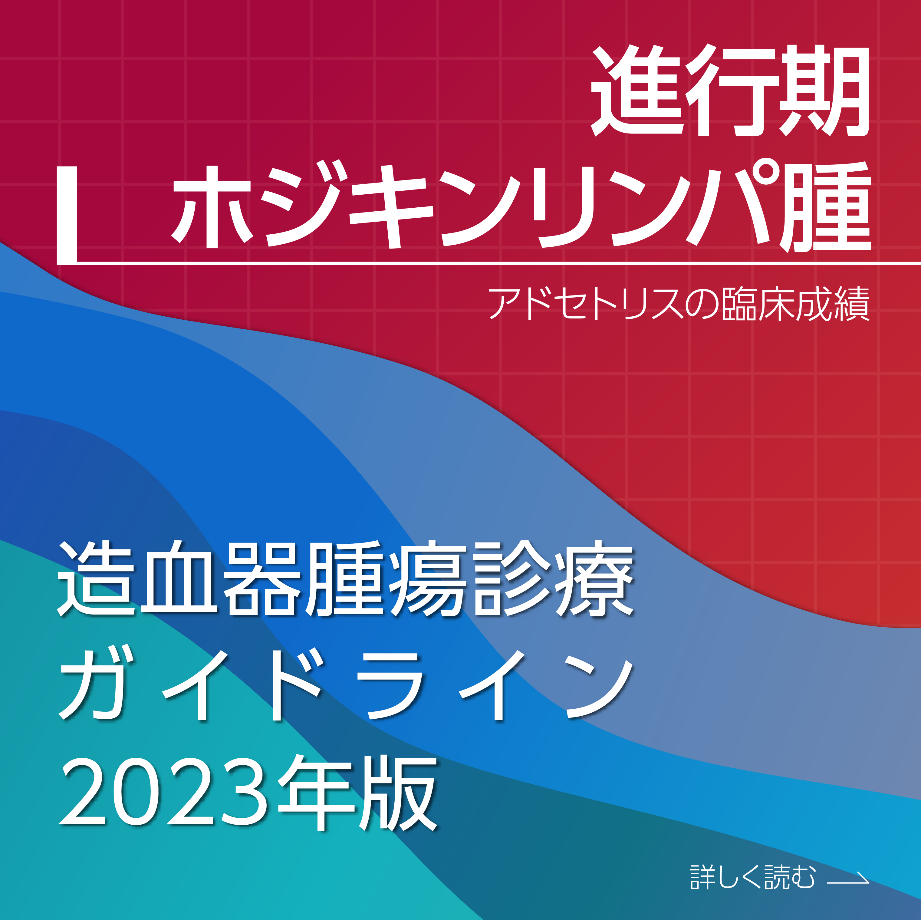 進⾏期ホジキンリンパ腫