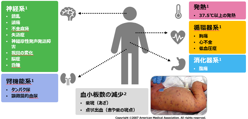 TTP（血栓性血小板減少性紫斑病）の症状｜【公式】武田薬品 医療関係者