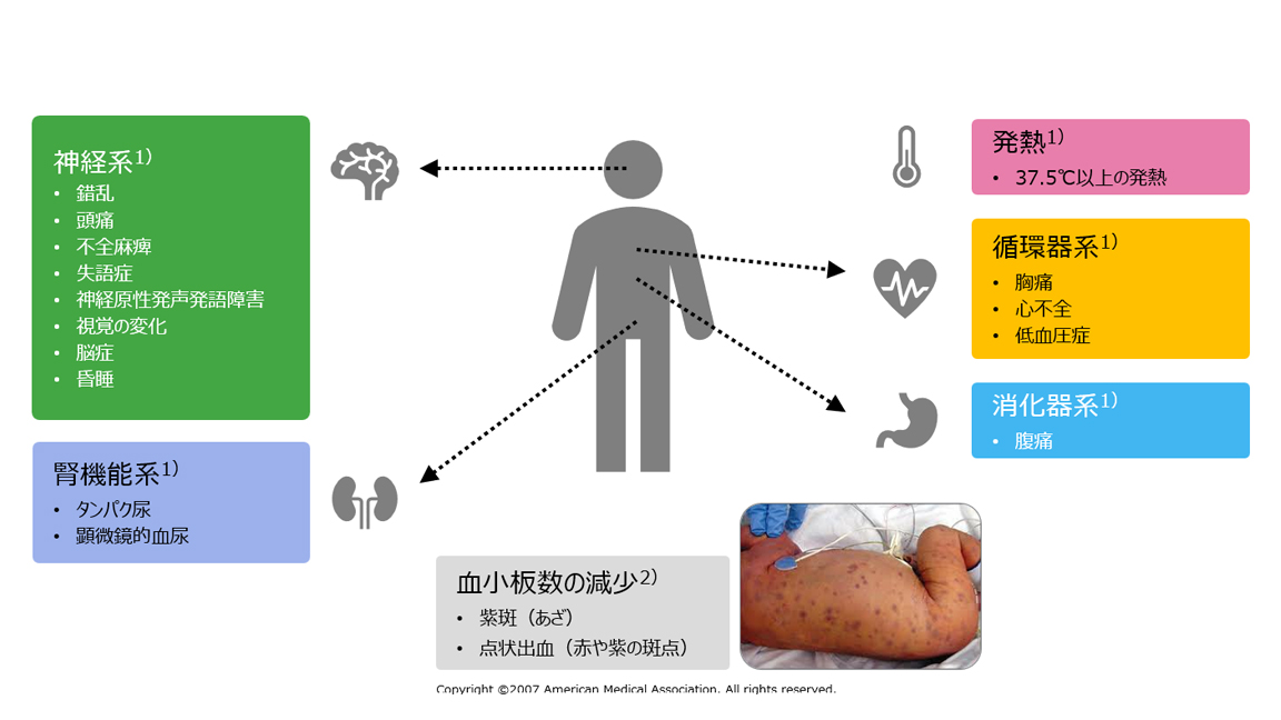 図1:急性TTPの症状1,2)
