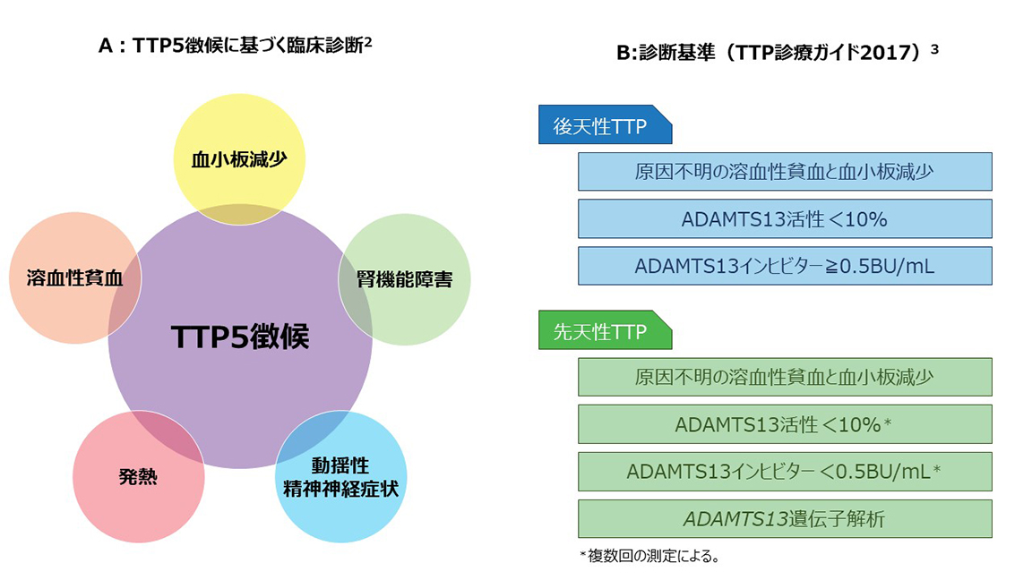図1:TTPの診断